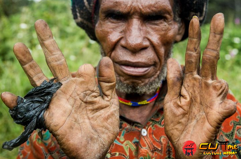 Mengapa Suku Papua Lakukan Iki Palek? Ini Jawabannya!